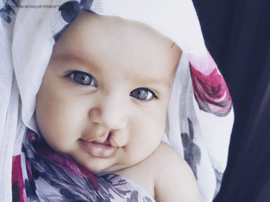 CLDF aprova direito ao teste de fissura labiopalatal em recém-nascidos