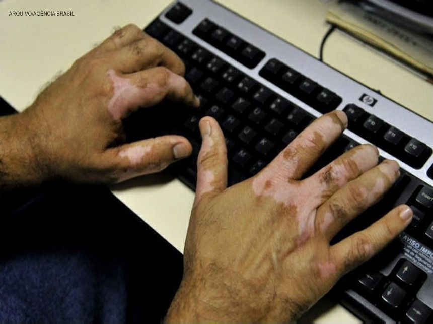 Pacientes com vitiligo do DF ganham novos benefícios
