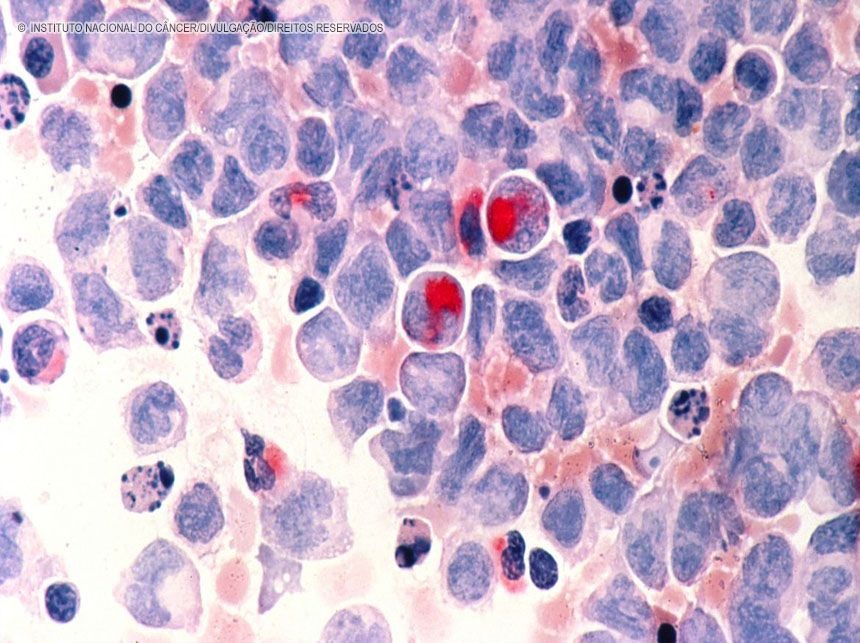 ANS inclui opções de quimioterapia oral em seu rol de procedimentos