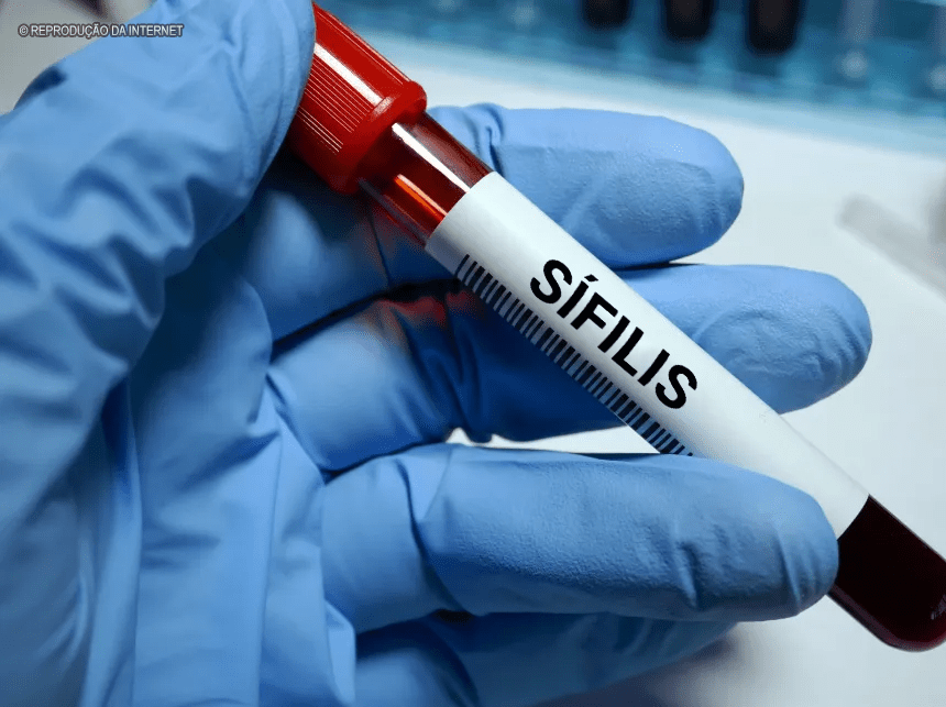 SUS oferece cursos gratuitos para combate a sífilis