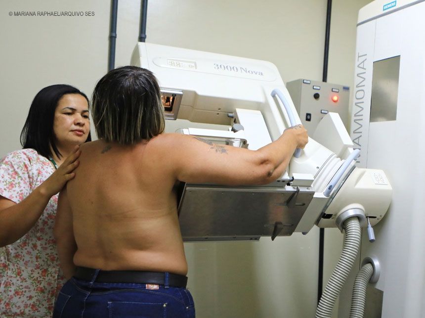 Médico mostra importância da mamografia para prevenir câncer de mama