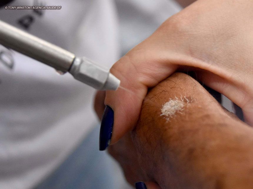 Força-tarefa de dermatologia atende mais de 500 pacientes no HRAN