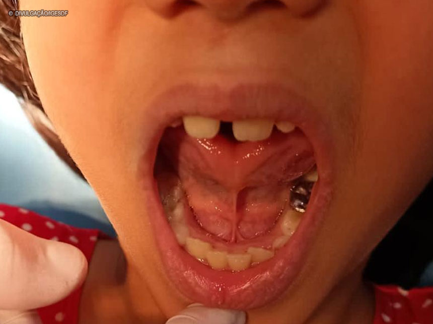 Hospital de Santa Maria realizará segundo mutirão odontológico