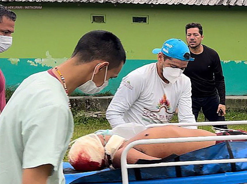 Um agente de saúde indígena é morto e dois são feridos em ataque na Terra Yanomami