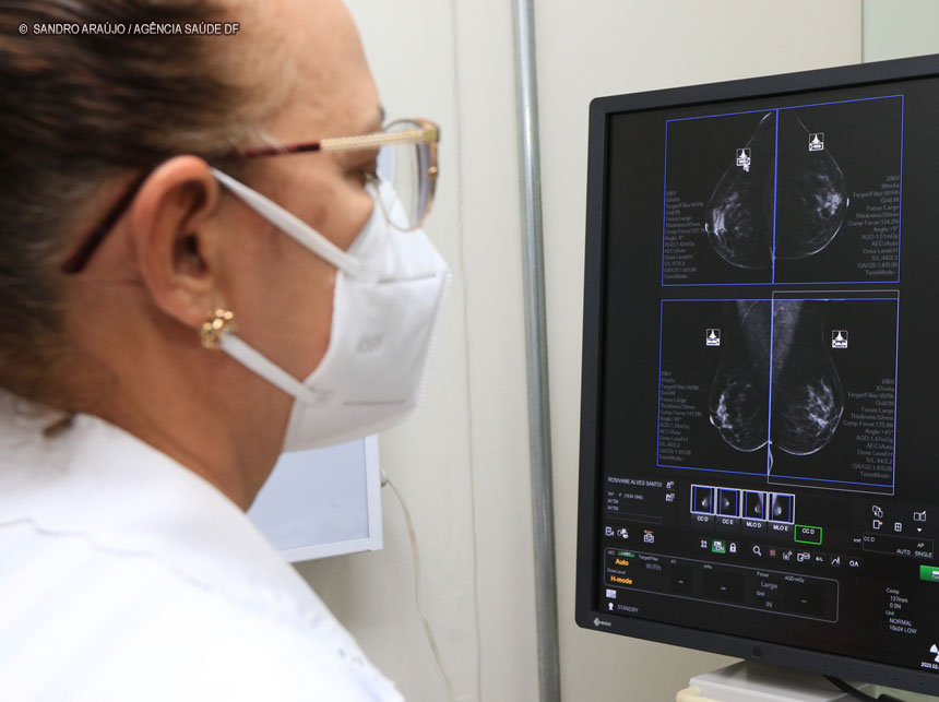 Ibaneis sanciona lei que define prioridades para exames de mamografia no DF