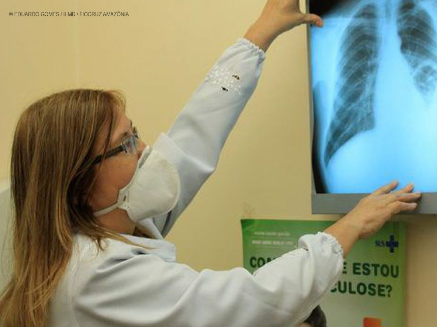 Governo cria comitê para eliminar a tuberculose