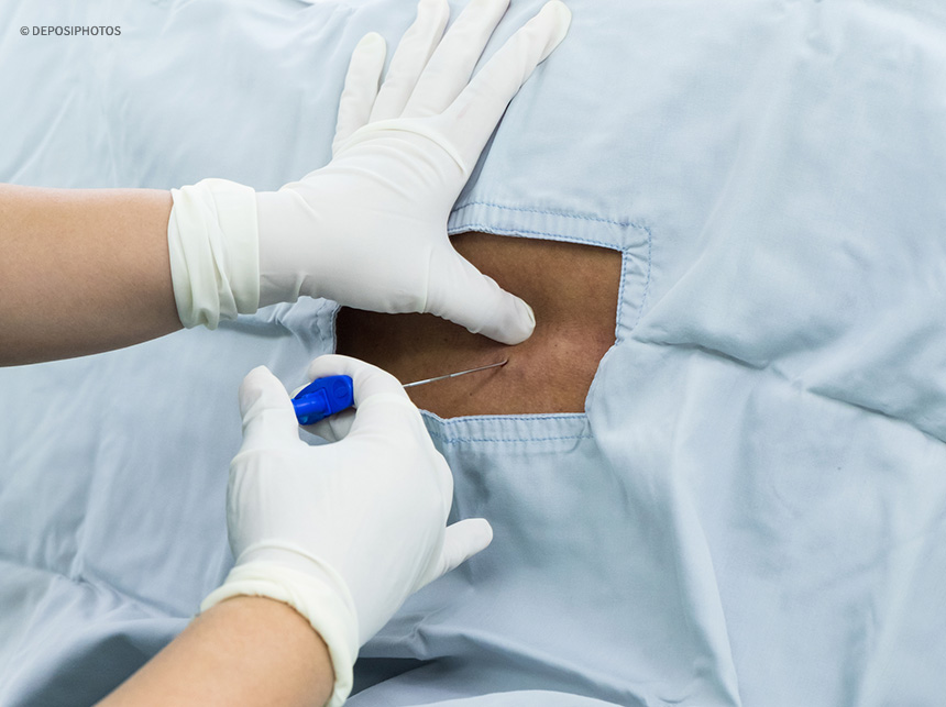 Falta de anestesistas preocupa secretária de saúde do DF que pede por modelo de contratação alternativo