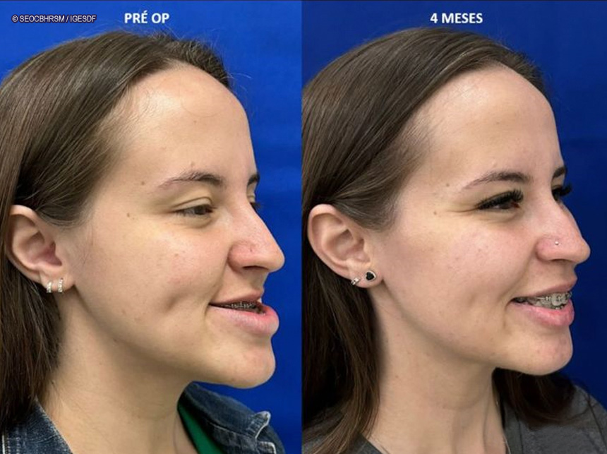 Serviço de Deformidades de Face do HRSM completa quatro anos de atuação