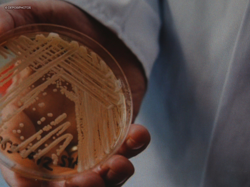 São Paulo confirma primeiro caso de superfungo Candida auris