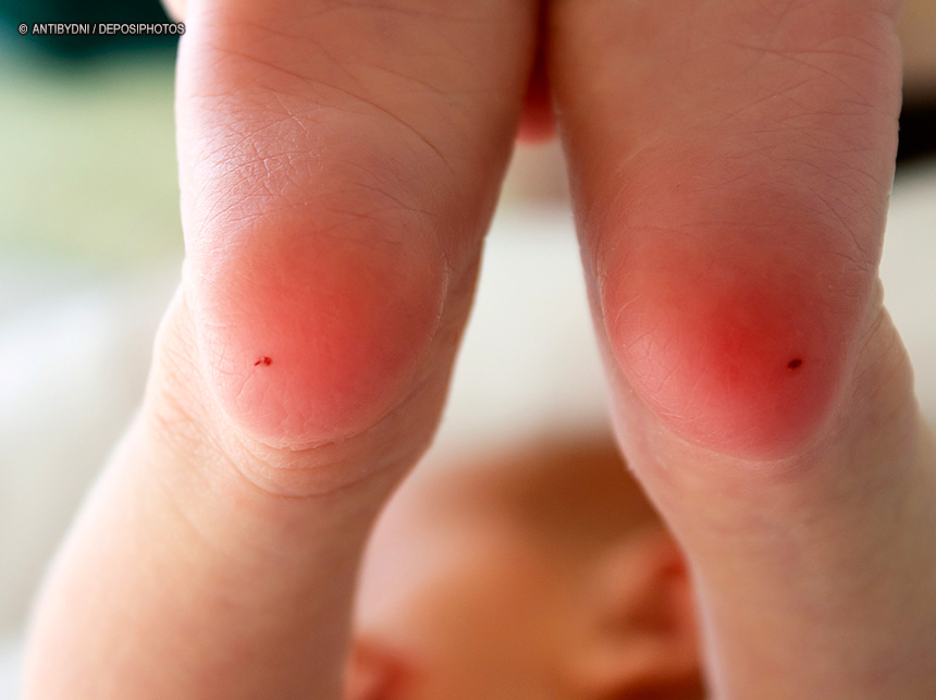 Entra em vigor, lei que institui semana nacional de informação sobre doenças raras