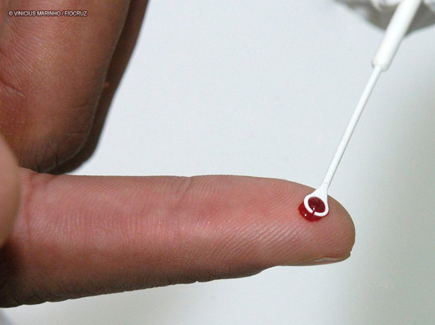 Medicamento injetável é nova opção de prevenção contra HIV no Brasil