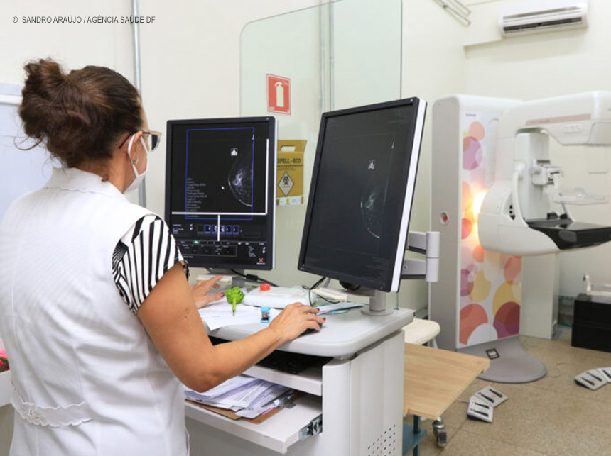 DF reduz fila de mamografia em mais de 70% com ampliação do serviço