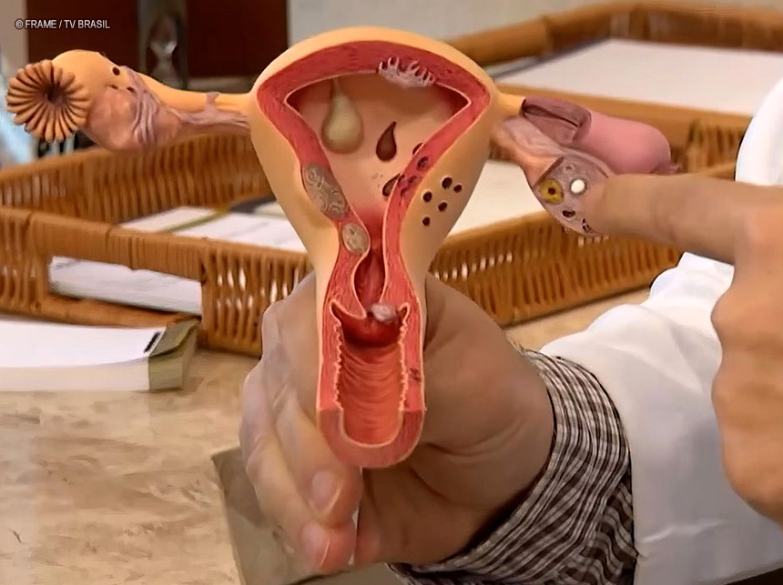 Julho Verde-Escuro conscientiza sobre prevenção ao câncer ginecológico