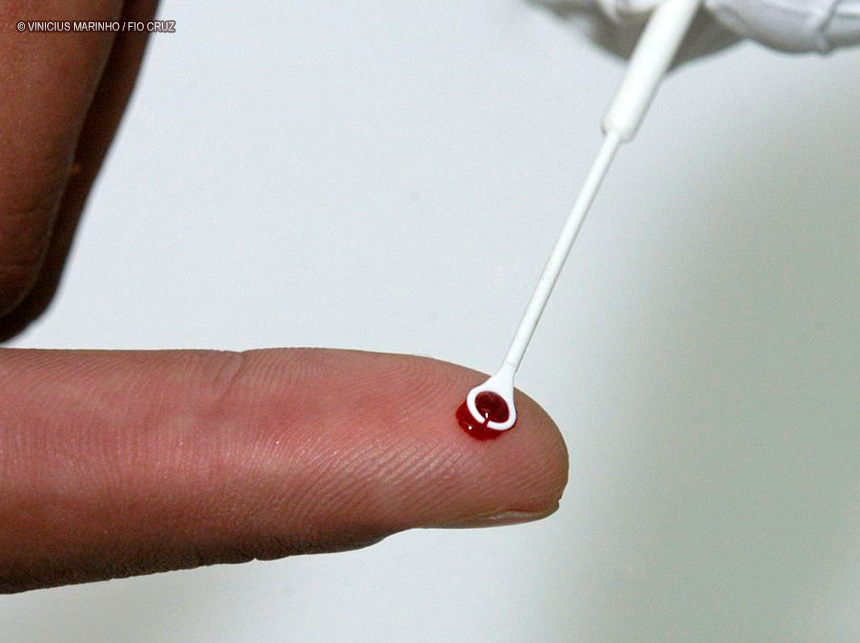 PrEP: tratamento preventivo é alternativa no combate ao HIV no Brasil