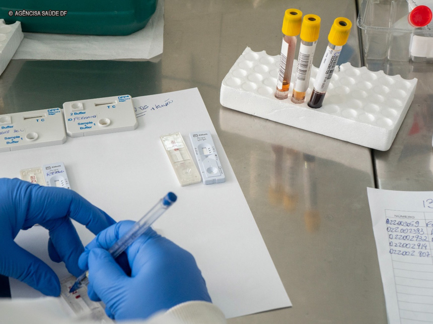 São Sebastião e Jardins Mangueiral ganham novos pontos para coleta de exames