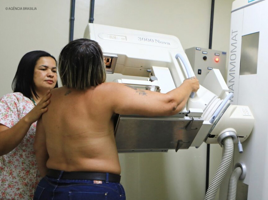 GDF reduz em 80% fila para mamografia e para primeira consulta de oncologia