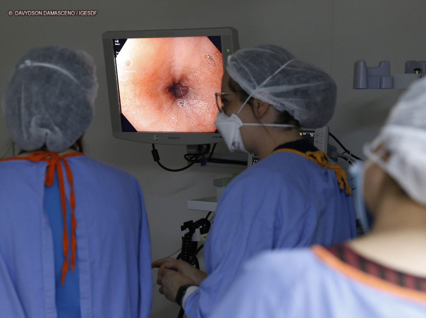TCDF aponta baixa produtividade na realização de endoscopias digestivas pela rede pública e cobra providências