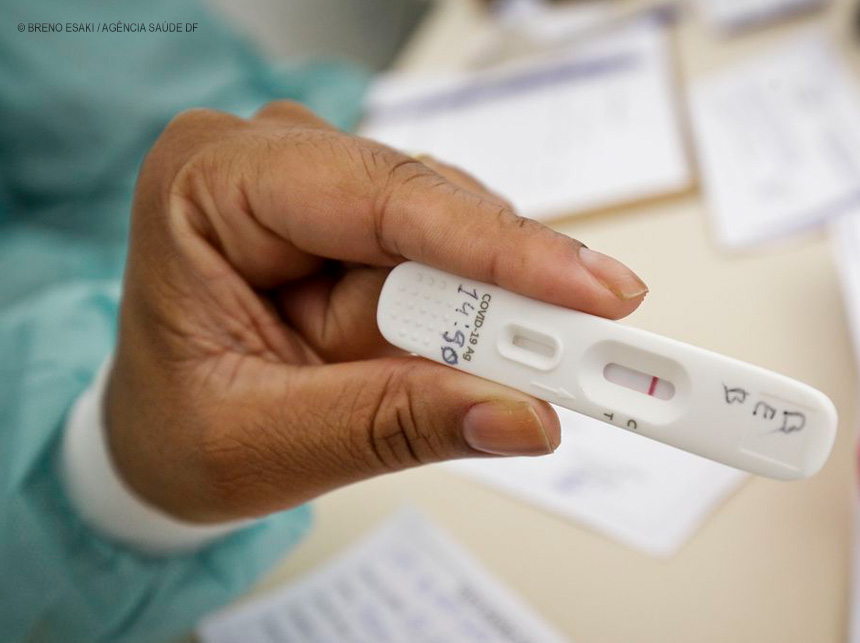 Positividade de testes de covid-19 subiu de 4% para 13%, diz UFRJ