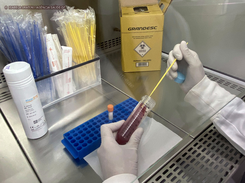 Cepoteca reforça controle de qualidade nos testes que identificam bactérias