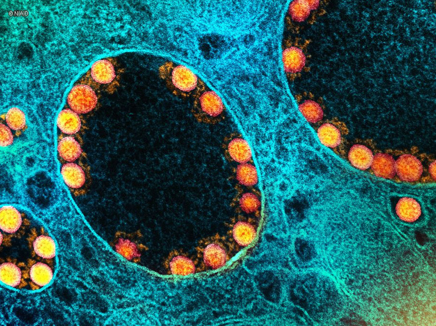 Covid-19: 51% da população quer julgamento e punição por mortes