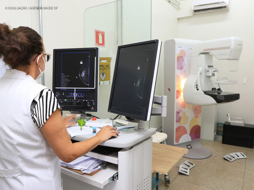 Nova logística e carga horária maior agilizam exames de mamografia