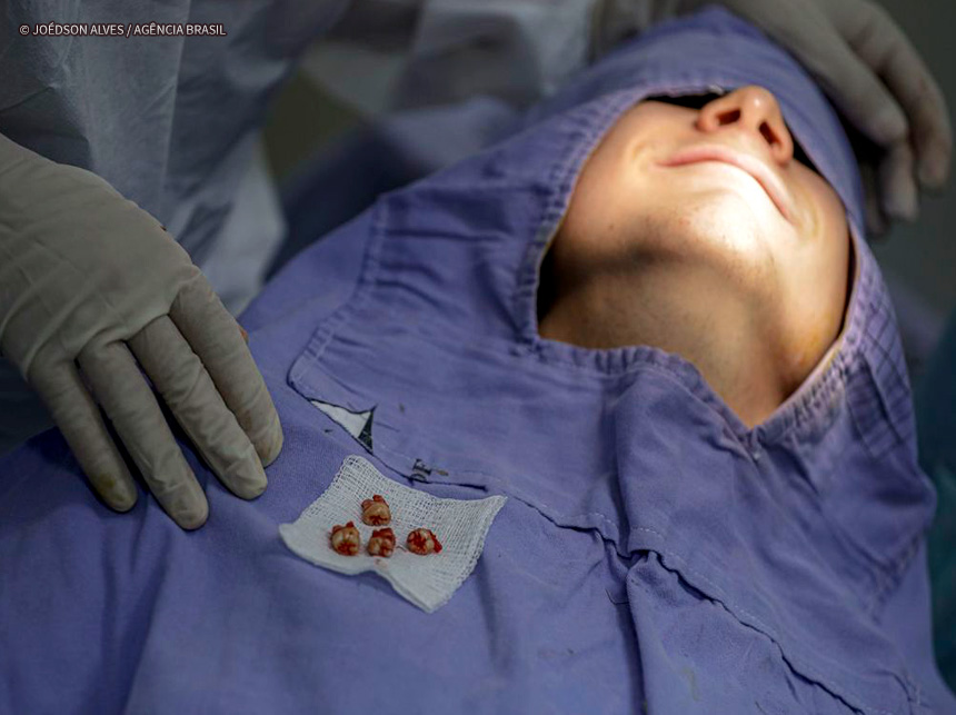 Brasil Sorridente deverá cobrir 62,5% da população em 2024