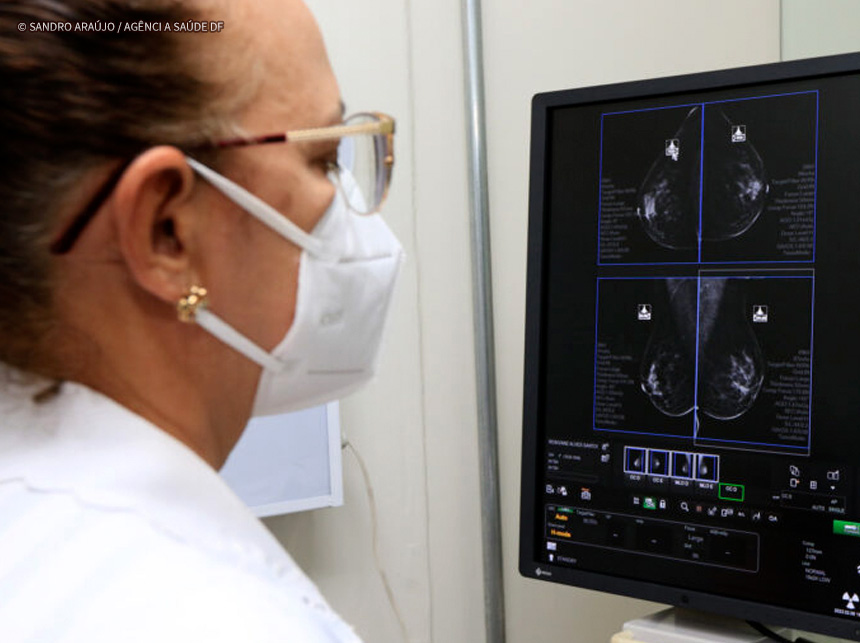 GDF integra unidades e zera lista de espera por mamografias