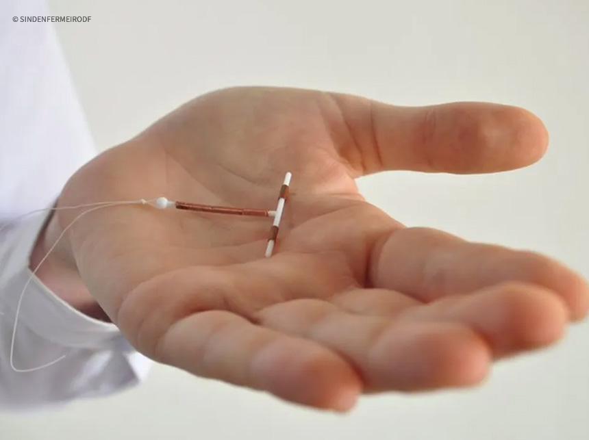 Saúde do DF libera a inserção do DIU por enfermeiros