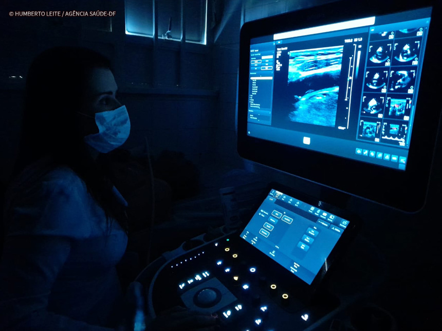 Novo equipamento agiliza exames cardíacos no Hospital Regional de Ceilândia