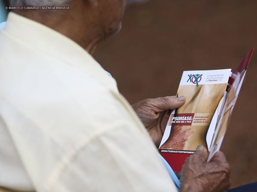 Saúde oferece tratamento para psoríase, doença não contagiosa no DF