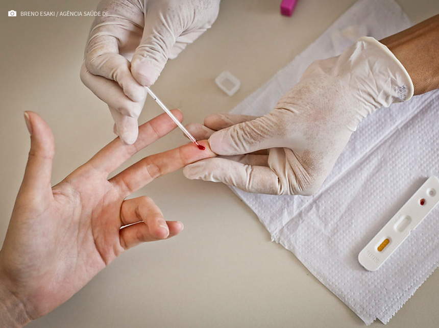 Com testagem e tratamento imediato, DF reduz número de mortes por HIV