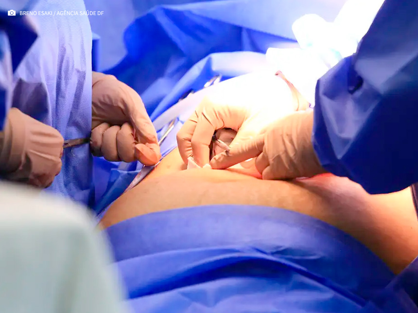 Cinco estados podem zerar fila de cirurgias no SUS em 2024