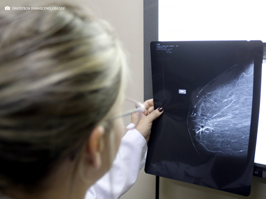 MPDFT cobra esclarecimentos à SES por descumprimento de acordo para atendimento a pacientes com câncer