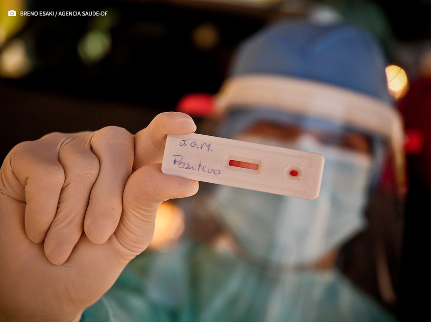 Casos de covid-19 no DF caem 5,5% em uma semana