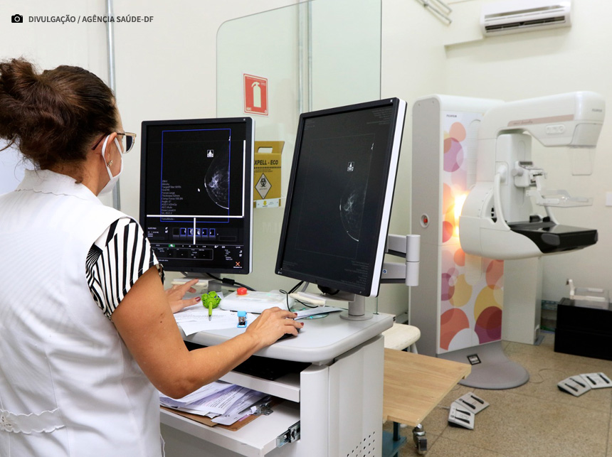 Mamografia tem papel fundamental no diagnóstico precoce do câncer de mama