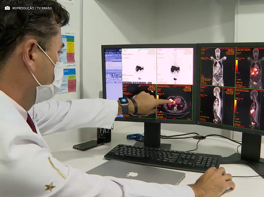 Campanha Março Azul prioriza a prevenção do câncer de intestino