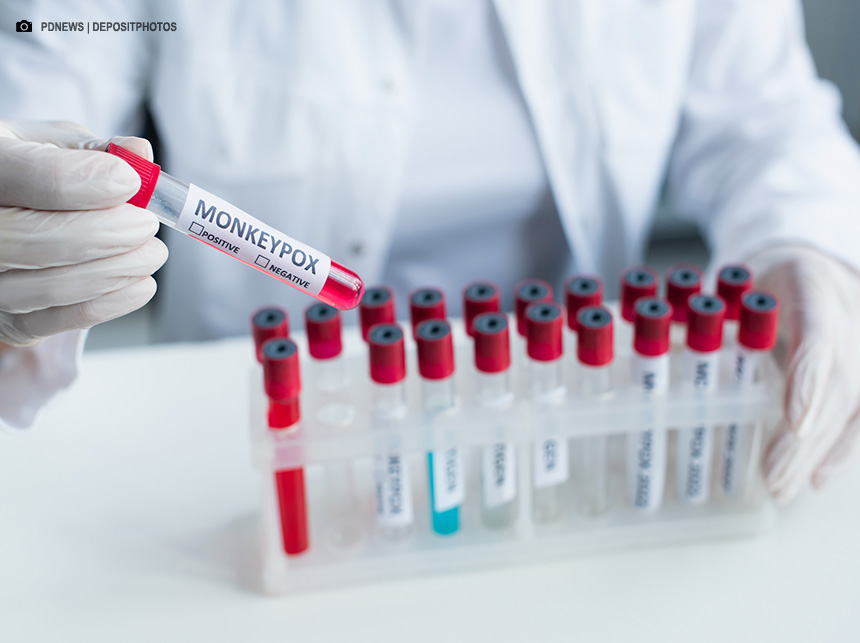 Mpox: OMS pede que fabricantes submetam vacina para uso emergencial