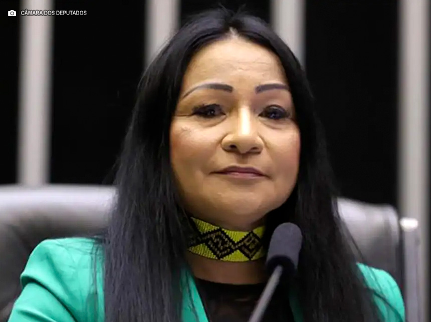 Deputada é cassada por pagar tratamento estético com dinheiro público