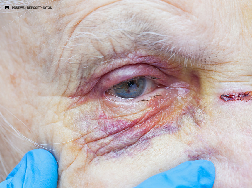 MPDFT atua na conscientização sobre a violência contra a pessoa idosa