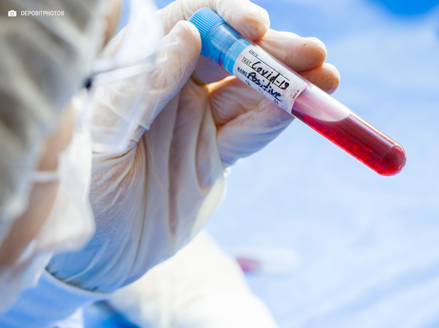 Covid-19: Rio vacina população contra variante XBB até este domingo domingo (25)