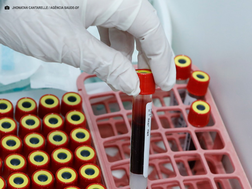 Ação avalia nível de anticorpos dos profissionais de vigilância ambiental