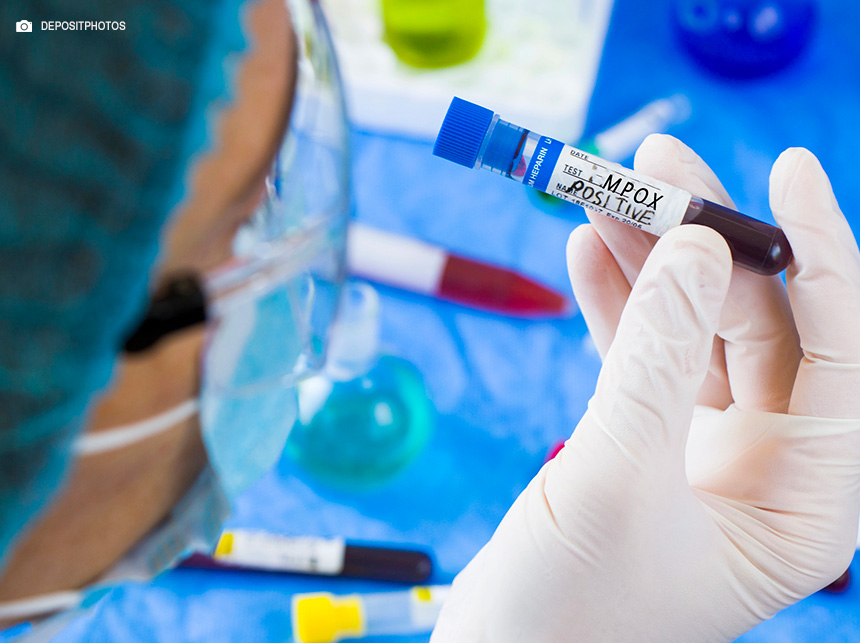 Anvisa renova dispensa de registro de duas vacinas contra mpox