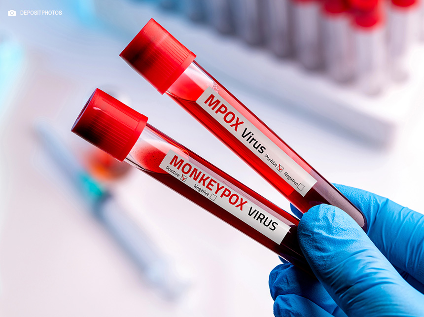 Congo tem mais de 18 mil casos e 615 mortes por mpox