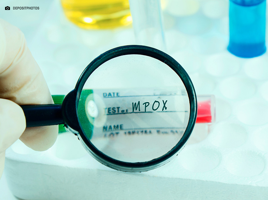 Estados Unidos confirmam primeiro caso de nova variante da mpox