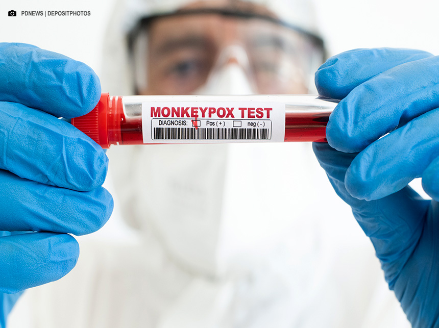 Mpox: saiba quais doenças já tiveram mais alto nível de alerta global