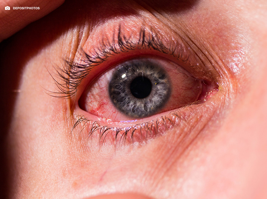 Procedimentos estéticos sem cautela podem causar complicações oculares