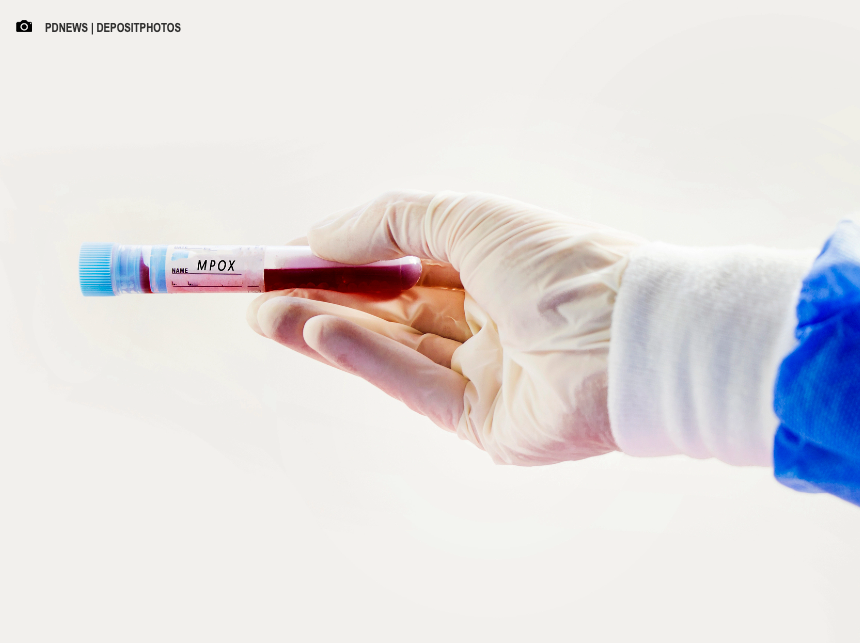 Cidade do Rio teve mais de 1.200 casos de mpox desde 2022