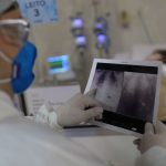 radiografia_de_torax_coronaviruscovid-19_hospital_sao_paulo1205200326.jpg
