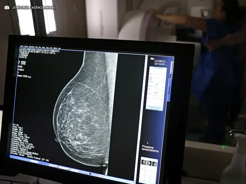 Outubro Rosa: mulheres têm exames gratuitos na rodoviária de Brasília