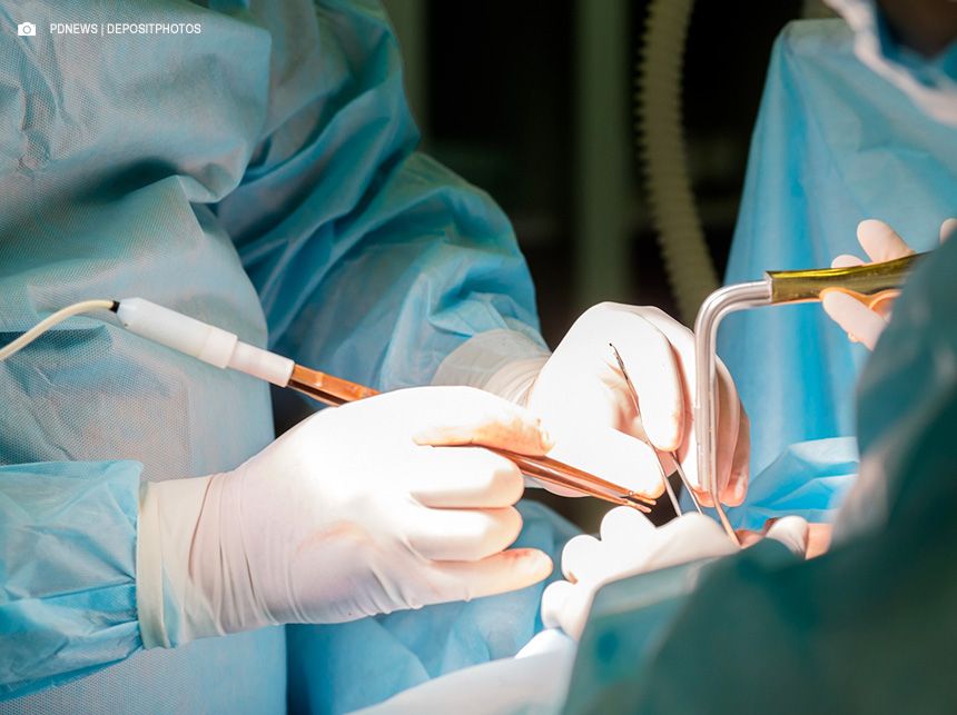 Médicos alertam sobre riscos de lipoaspiração fora de hospital